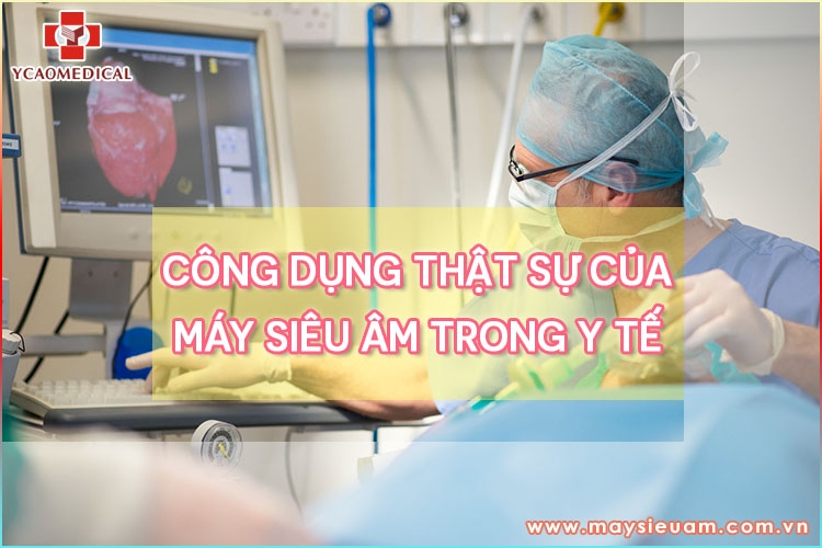 cong dung that su cua may sieu am trong y te