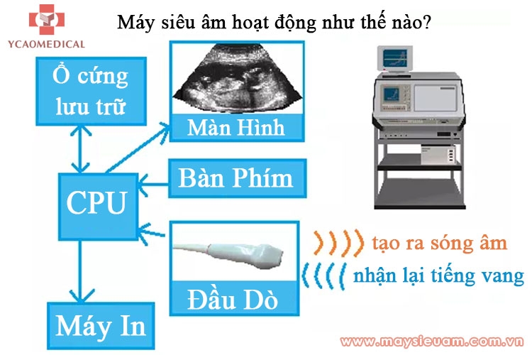 may sieu am   cach hoat dong loi ich rui ro va tuong lai