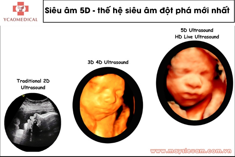 Quá trình xử lý và xem hình ảnh siêu âm 4D và 5D diễn ra như thế nào?