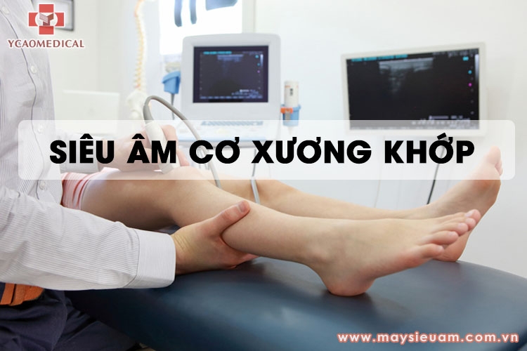 su dung may sieu am cho co xuong khop