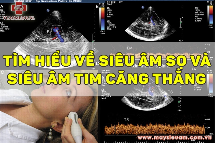 tim hieu ung dung sieu am so va sieu am tim cang thang